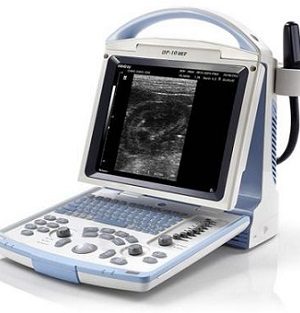 Digital Ultrasound Scanner