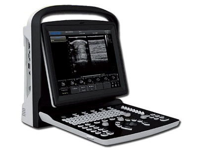 Digital Ultrasound Scanner